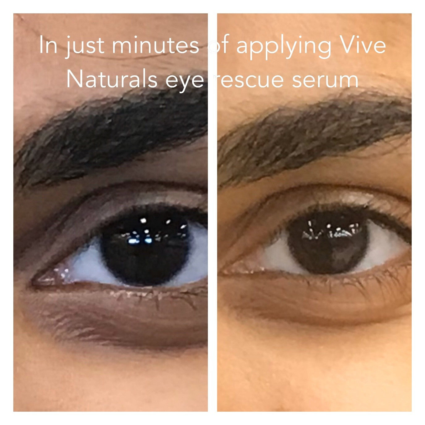 Eye Rescue Serum